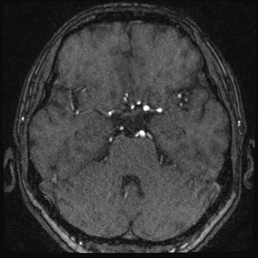 Click on the Serie image to view the images of VILLANUEVA, WILLIAM A.